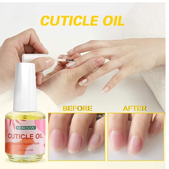 Nail Recovery Kit - Picture 2 of 7